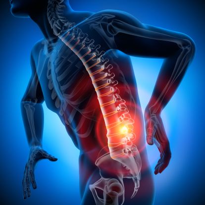 back pain graphic